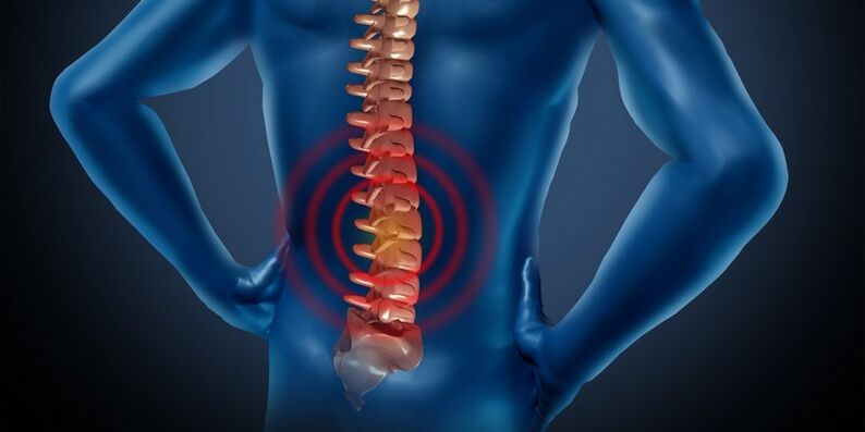 Osteochondrosis of the lumbar region