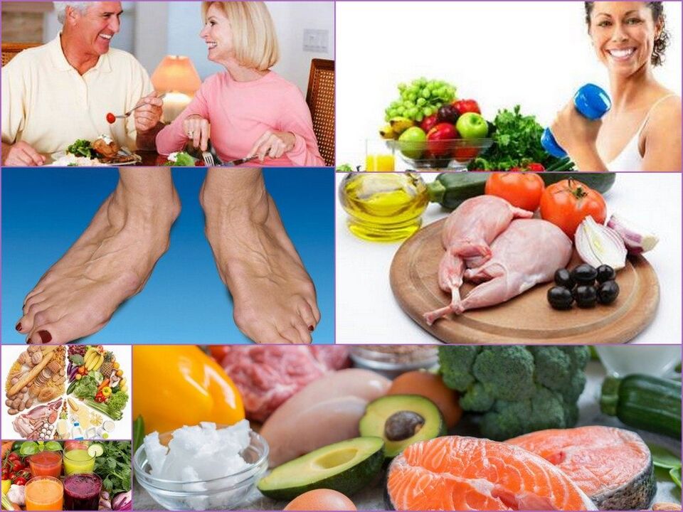 Nutrition principles for those suffering from arthrosis of the knee joint